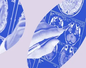Grafika, na której jest zdjęci rezonansu mózgu i dłoń z długopisem która coś wskazuje z fioletowymi elementami graficznymi. Medicante