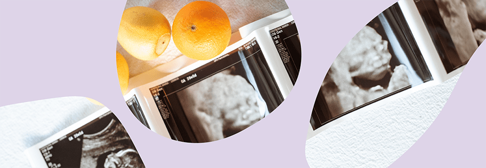 Zdjęcie ukazujące wydruk usg nienarodzonego dziecka z fioletowym motywem graficznym na zdjęciu.